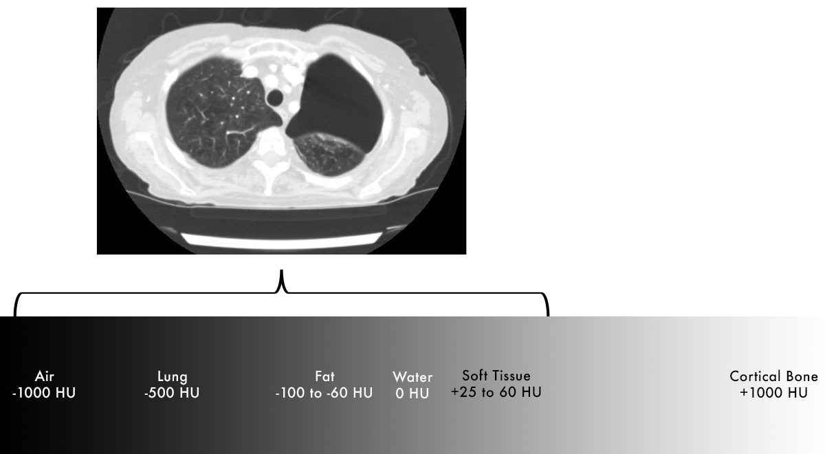 Hounsfield Units Lung Window